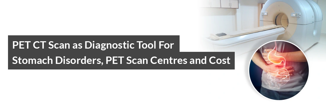 PET CT Scan as Diagnostic Tool for Stomach Disorders, PET Scan Centres and Cost